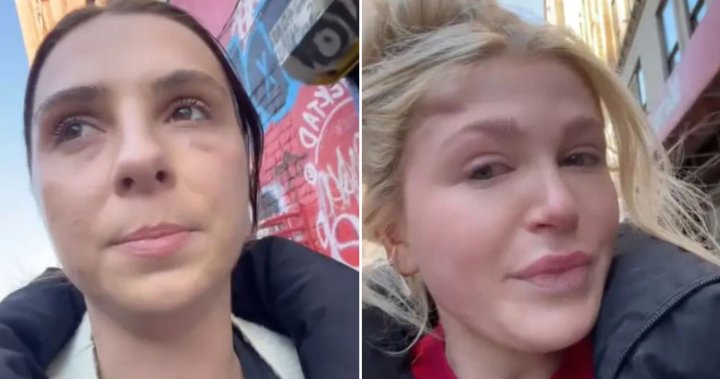 TikTok claims of women being sucker-punched in NYC investigated by police – National