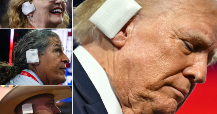 Summer’s hottest accessory? Trump-inspired ear bandages take over RNC – National