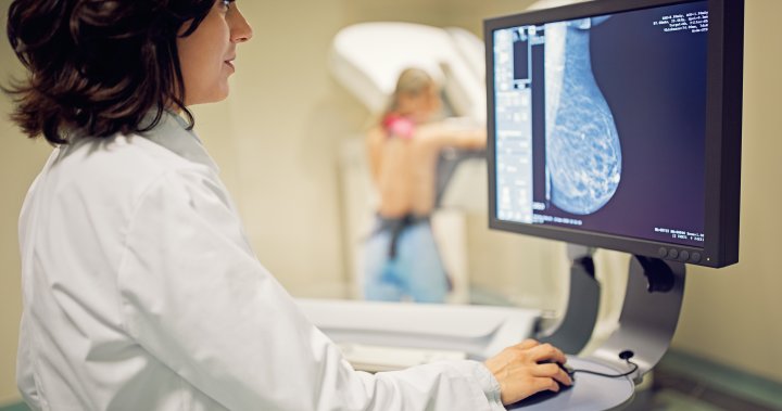 How to advocate for a mammogram under age 50: ‘Don’t be afraid to speak up’ – National